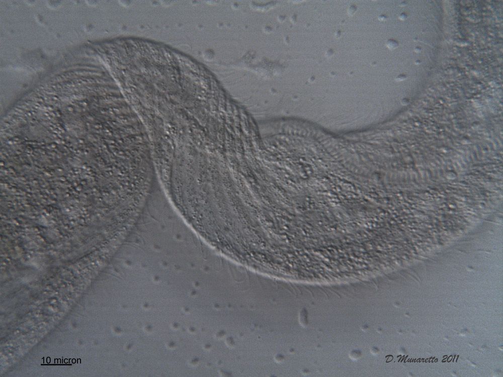 Spirostomum